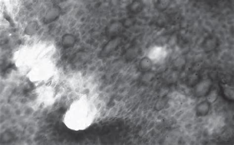 Impression Cytology Normal Conjunctival Epithelium Uniform Field Of