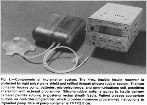 The Implantable Insulin Pump History Chapter Two