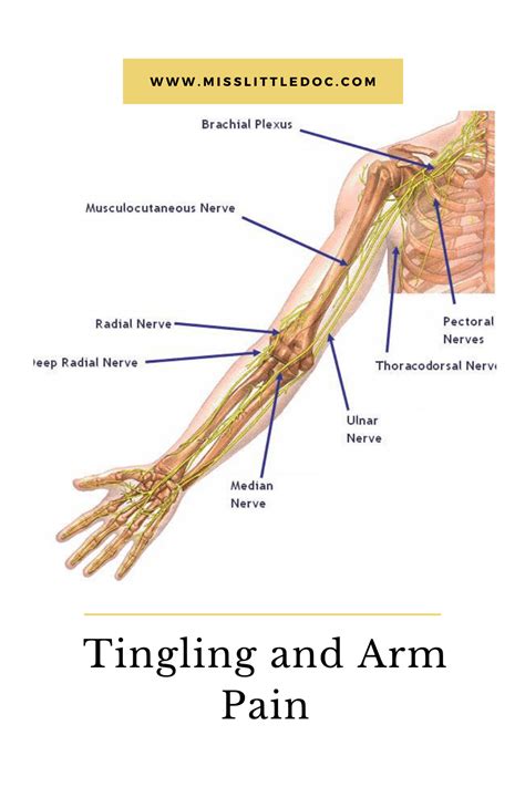 Severe Pain In Left Shoulder And Arm With Tingling In Fingers Artofit