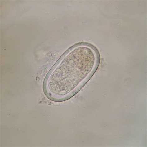 Enterobius Vermicularis Under Microscope