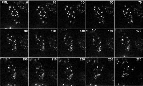 Time Lapse Live Cell Microscopy Detecting The Redistribution Of Pml Download Scientific Diagram