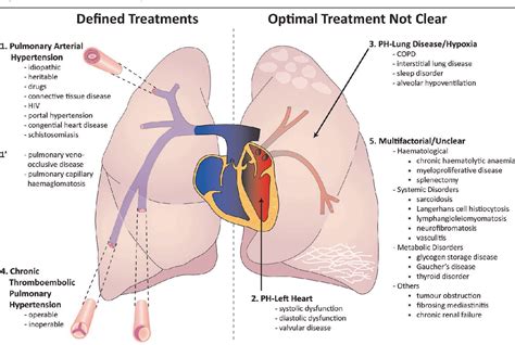 Figure 1 From Connective Tissue Disease Associated Pulmonary Arterial Hypertension Semantic