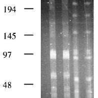 Pulsed Field Gel Electrophoresis Patterns Of Sma I Digested Genomic