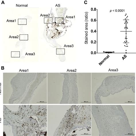 Cyclooxygenase 1 Cox1 Protein Levels Were Increased In Valve