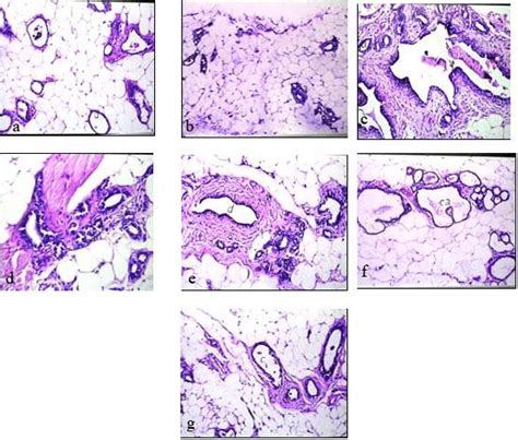 Light Microscopic Photos Of Rats Mammary Gland Showing A In Control