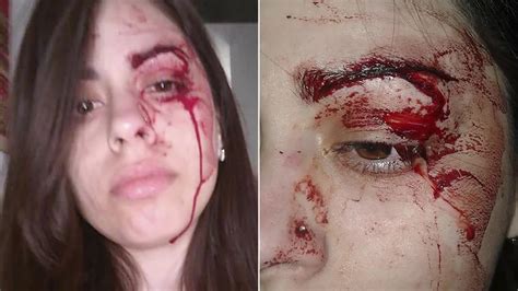 Una Joven Fue Golpeada Por Su Ex Pareja Delante De Su Hija De Tres Años