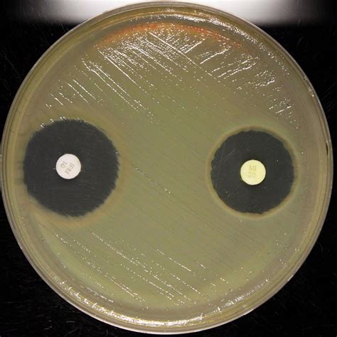 Anton Van Microbiology On Instagram Acinetobacter Baumannii Vs