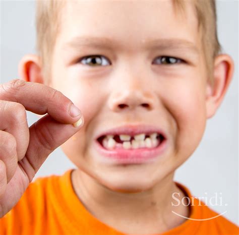 Trauma Ai Denti Da Latte Ecco Cosa Fare Se Il Bimbo Cade E Batte I