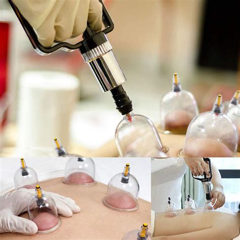 Cupping Set Professional Chinese Acupoint Cupping Therapy Sets Suction