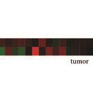 Expression Patterns And Prognostic Values Of Hnrnps In Pancreatic