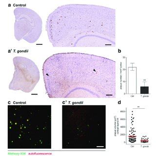 T Gondii Infection Leads To Reduced Plaque Burden In Xfad Mice A A