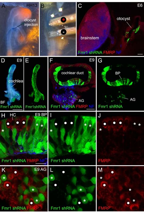 Dissecting Cell Autonomous Function Of Fragile X Mental Retardation