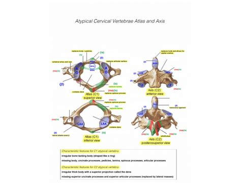 Atypical Cervical Vertebrae