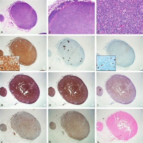 Morphological And Immunohistochemical Features Of An Omental Lymph