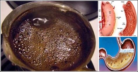 See What Happens When You Drink Coffee On An Empty Stomach Daily