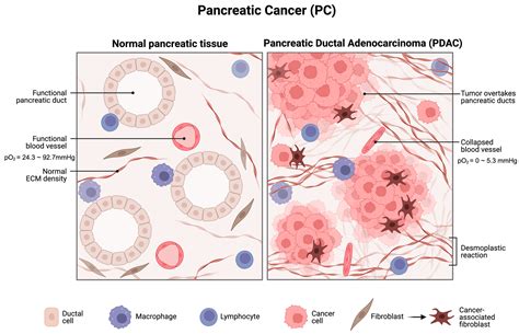 Impact Of Hypoxia Induced Mir 210 On Pancreatic Cancer