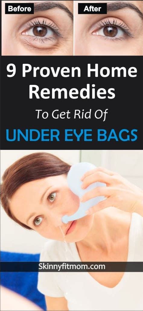 Learn How To Get Rid Of Under Eye Bag These 9 Home Remedies Are Tested