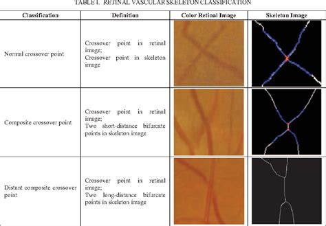 Figure 1 from Automatic detection of arteriovenous nicking in retinal ...