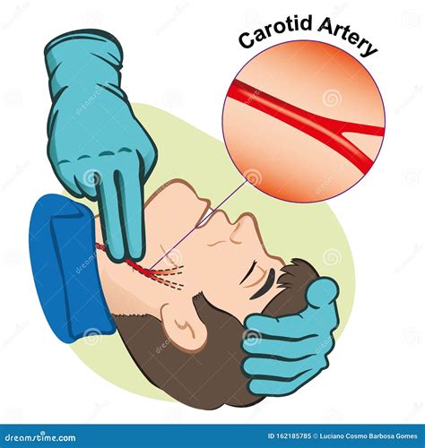 First Aid Illustration Person Measuring Pulse Through The Carotid ...