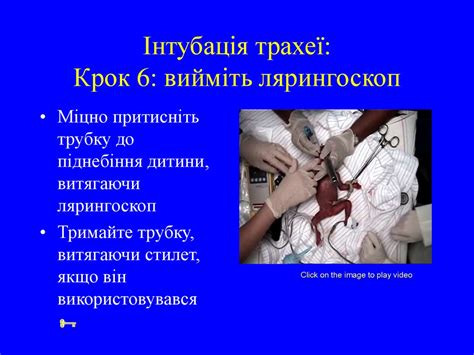 Інтубація трахеї - презентация онлайн