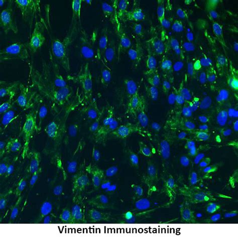 Immortalized Human Hepatic Stellate Cells Innoprot