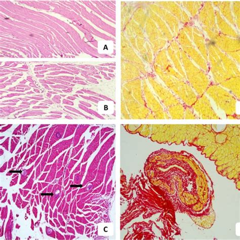 Skeletal Muscle Sections From The Healthy Control Group And Infected