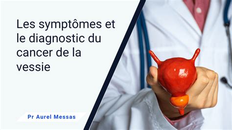 Cancer de la vessie symptômes et diagnostic Pr Aurel Messas