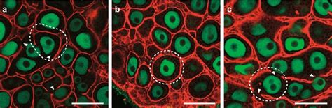 Abnormal Arrangement Of Laminin Basement Membrane In In Vitro Cultured