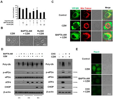 Ijms Free Full Text Psmd Targeting Triggers Paraptosis In Breast