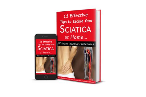 Sciatica Butheau Physiotherapy