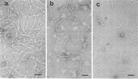 Electron Micrographs Of Negatively Stained Uranyl Acetate