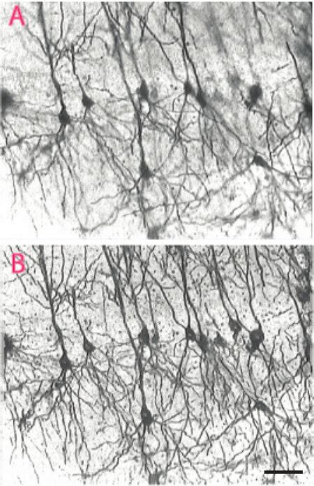 Visualization Of Dendritic Arborization Without A And With Edfi B