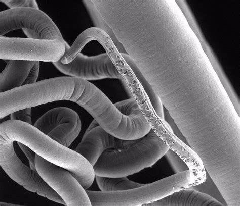 Los Gusanos Parásitos También Necesitan Su Microflora Intestinal