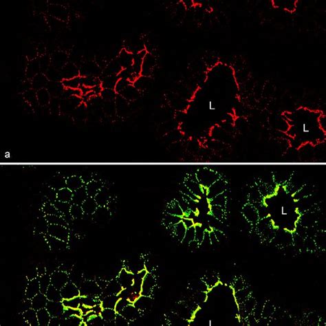 Confocal Laser Scanning Double Label Immunofluorescence Microscopy Of A