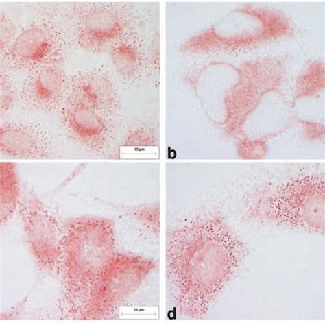 Effect On Proliferation Of Human Astrocytoma Cell Lines Under Control