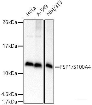 High Affinity And Specificity FSP1 S100A4 Polyclonal Antibody E AB