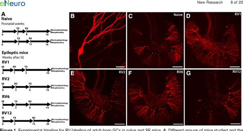 Table 1 From Restrained Dendritic Growth Of Adult Born Granule Cells