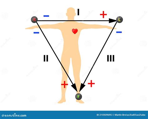 Einthoven ECG Triangle, Including Augmented Unipolar Limb Lead Stock ...