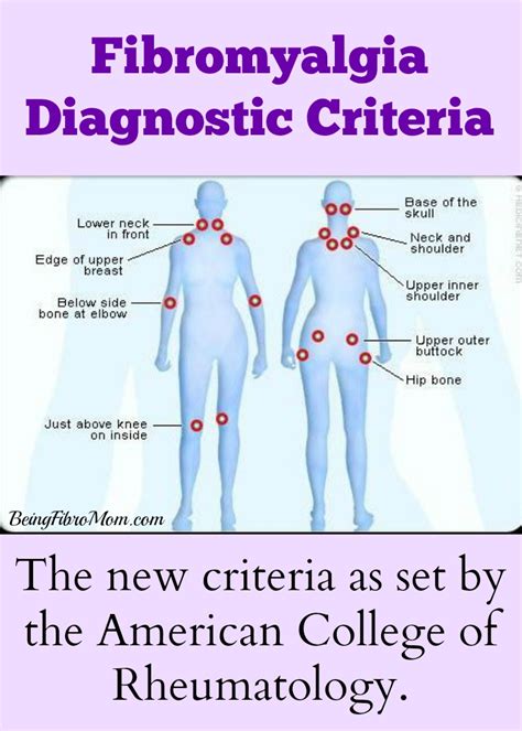 Fibromyalgia How Do You Know If You Have The Condition And Why