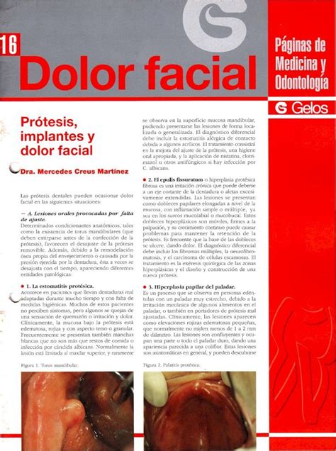 Pdf Pr Tesis Implantes Y Cl Nica Dental Padr S Pdf Fileg Gelos