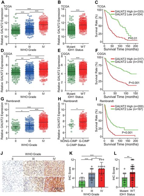 GALNT2 Sustains Glioma Stem Cells By Promoting CD44 Expression Figure