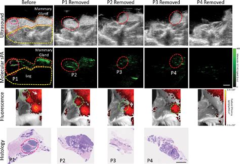 Figure From Intraoperative Resection Guidance With Photoacoustic And