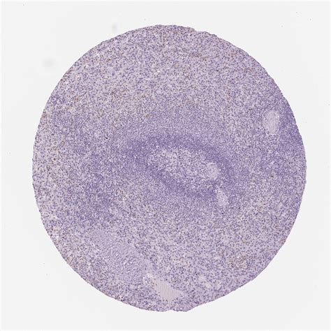 Tissue Expression Of MPO Staining In Spleen The Human Protein Atlas