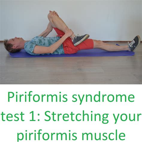 Piriformis Syndrome Causes And Treatment With 6 Exercises