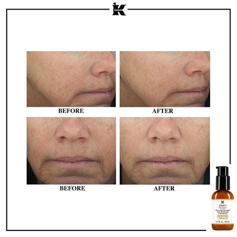 Powerful Strength Line Reducing Vitamin C Serum Kiehls Since 1851 ≡ Sephora