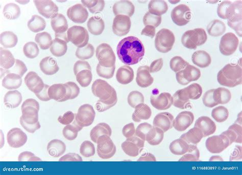 Neutrophil Cell in Blood Smear Stock Image - Image of abnormal, blood ...