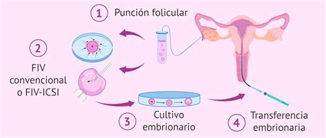 Todo Lo Que Debes Saber Sobre Los Requisitos Para La Fecundación In Vitro Una Guía Completa