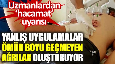 Uzmanlardan hacamat uyarısı