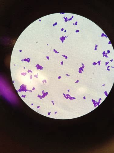 Lab 4 Bacterial Cells 1 Simple Negative Staining Flashcards Quizlet