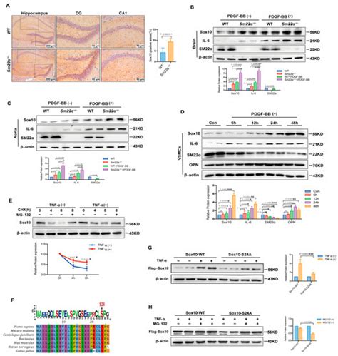 Ijms Free Full Text Sm Deletion Contributes To Neurocognitive